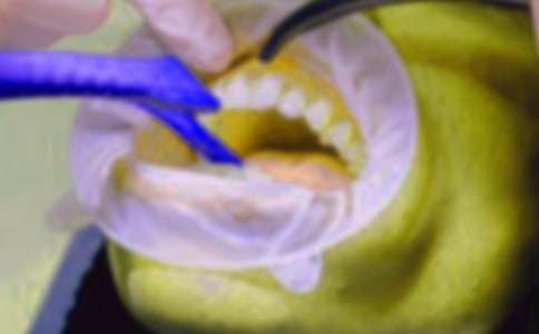 小兔子拔牙作文3篇