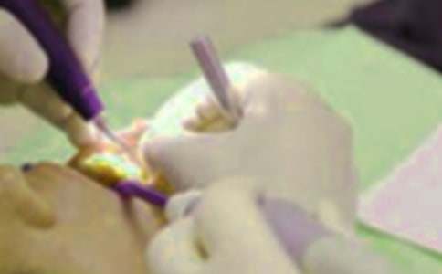 �����ǰ�����һӛ��������