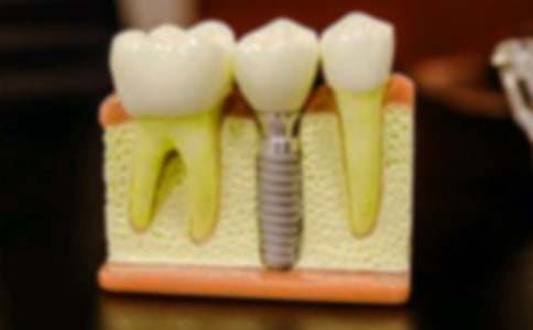 �ϰ֡��R�ڡ���������