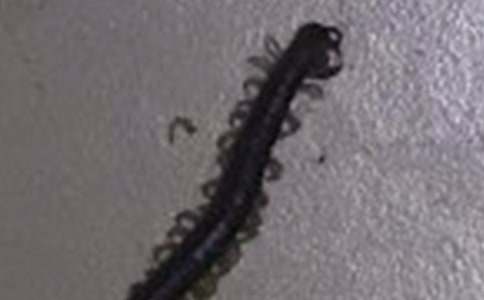 爸爸被蜈蚣咬了四年級(jí)作文